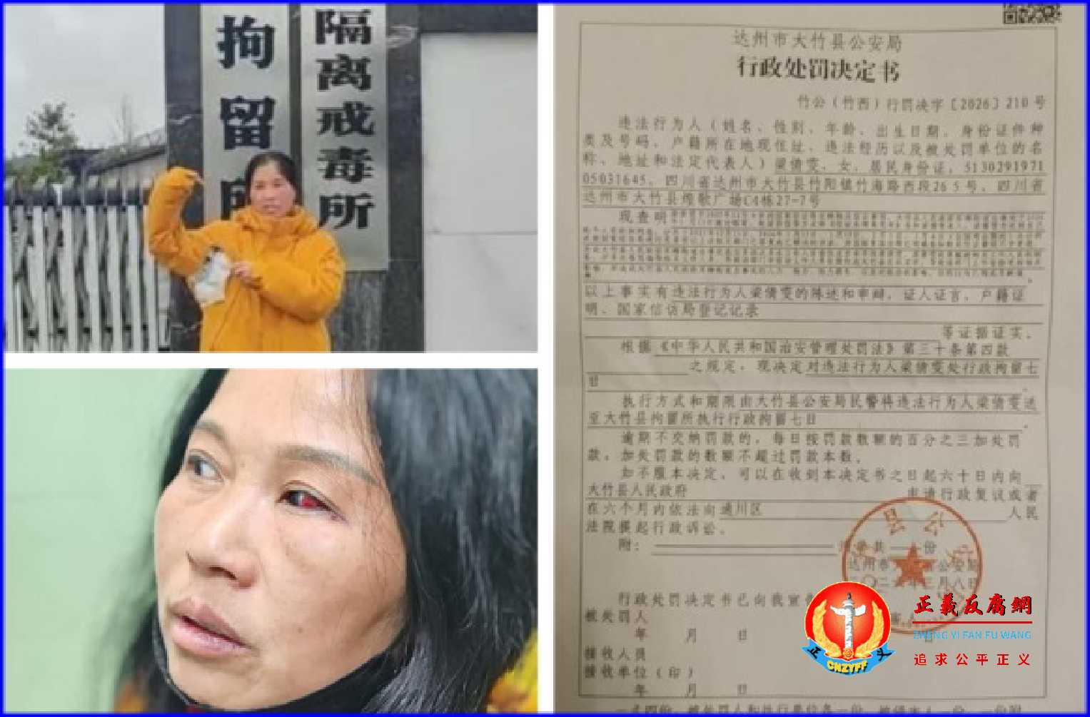 四川访民梁倩雯于2026年全国两会期间遭绑架殴打后报警反被被拘留7日。.jpg